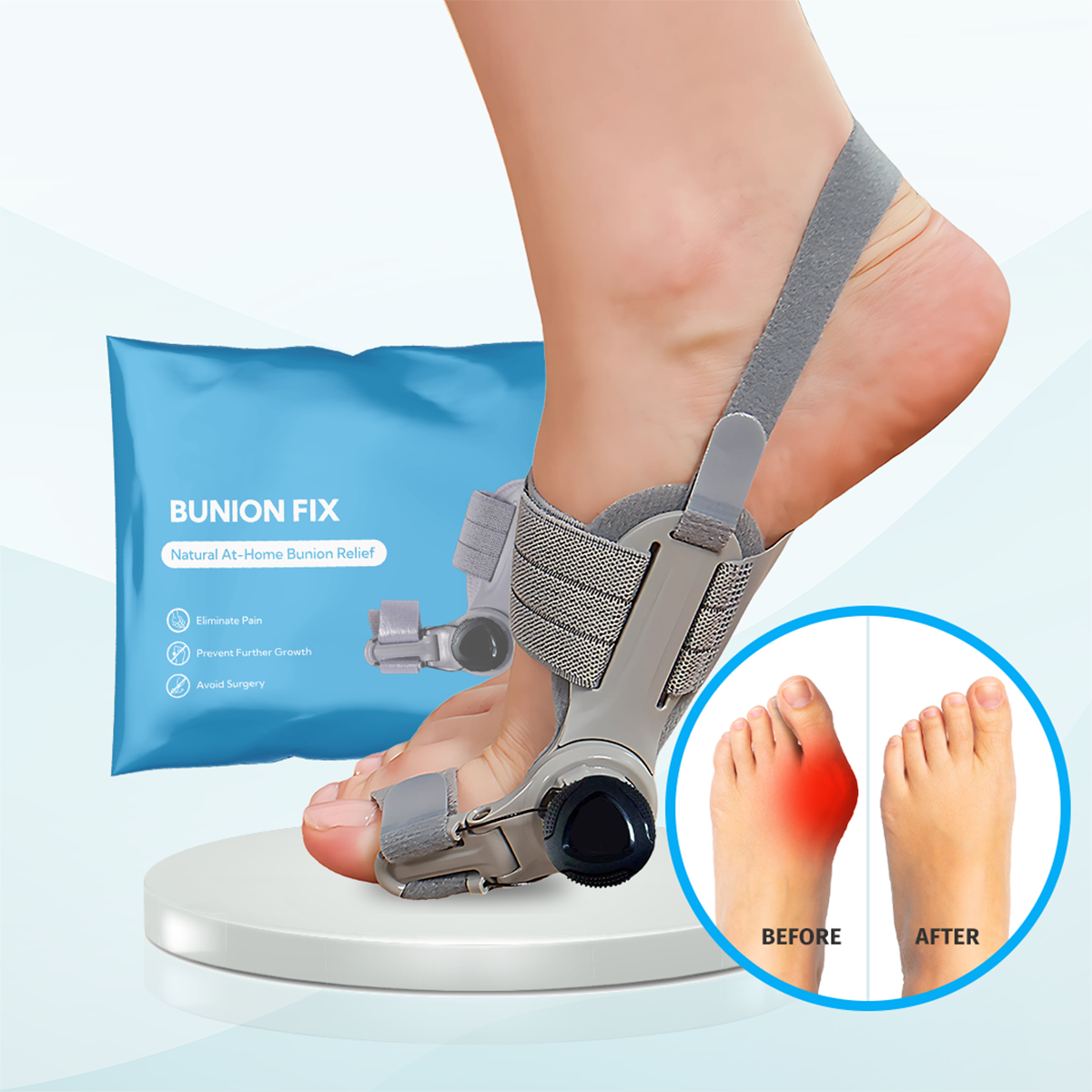 🔥Last Day Buy 1 get 1 free—49% off🔥JEREMYTIS™Adjustable Hallux Valgus Brace👣