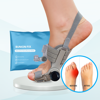 🔥Last Day Buy 1 get 1 free—49% off🔥JEREMYTIS™Adjustable Hallux Valgus Brace👣