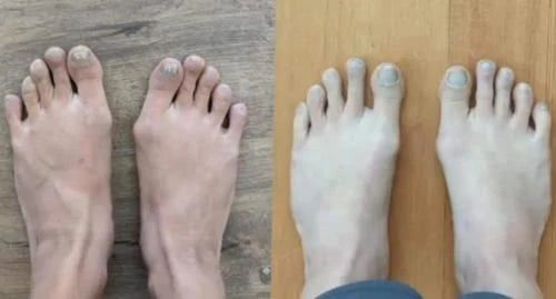 Customer foot comfort review image