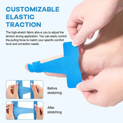 Customizable elastic traction bunion correction tape