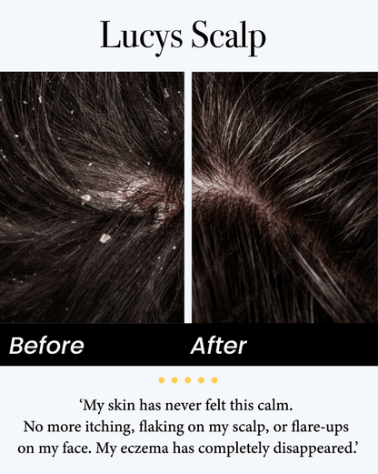 🔥Last Day -49% off🔥JEREMYTIS™ Natural Calming Serum✨